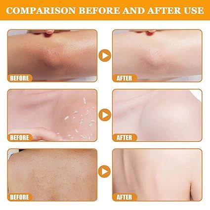 Orange Exfoliating Gel
