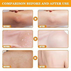 Orange Exfoliating Gel
